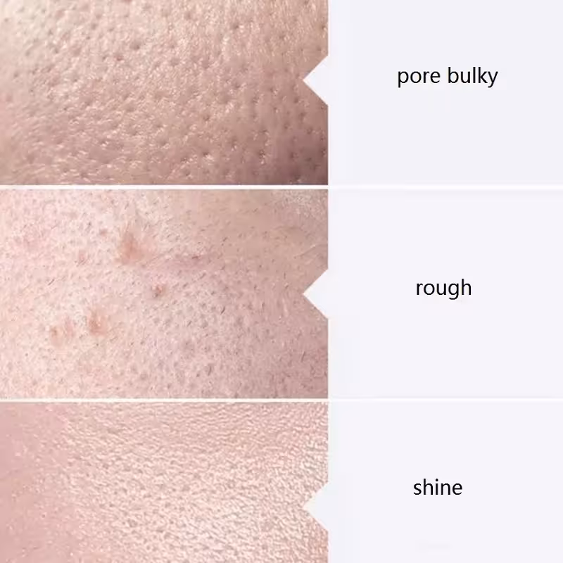 Gesichtsmasken-Serum aqua peel