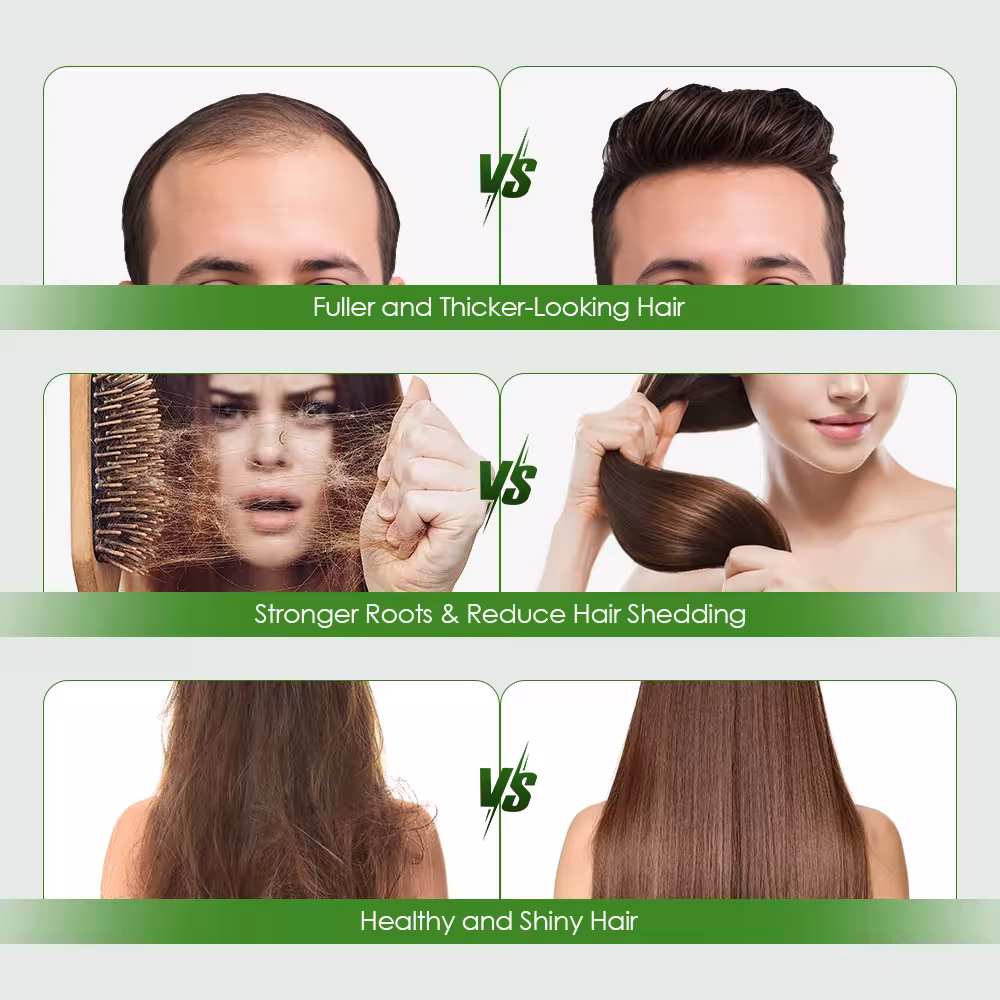 aumento dei capelli siero