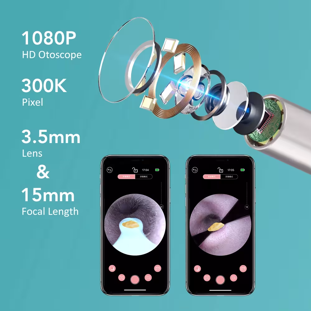 ear cleaning camera