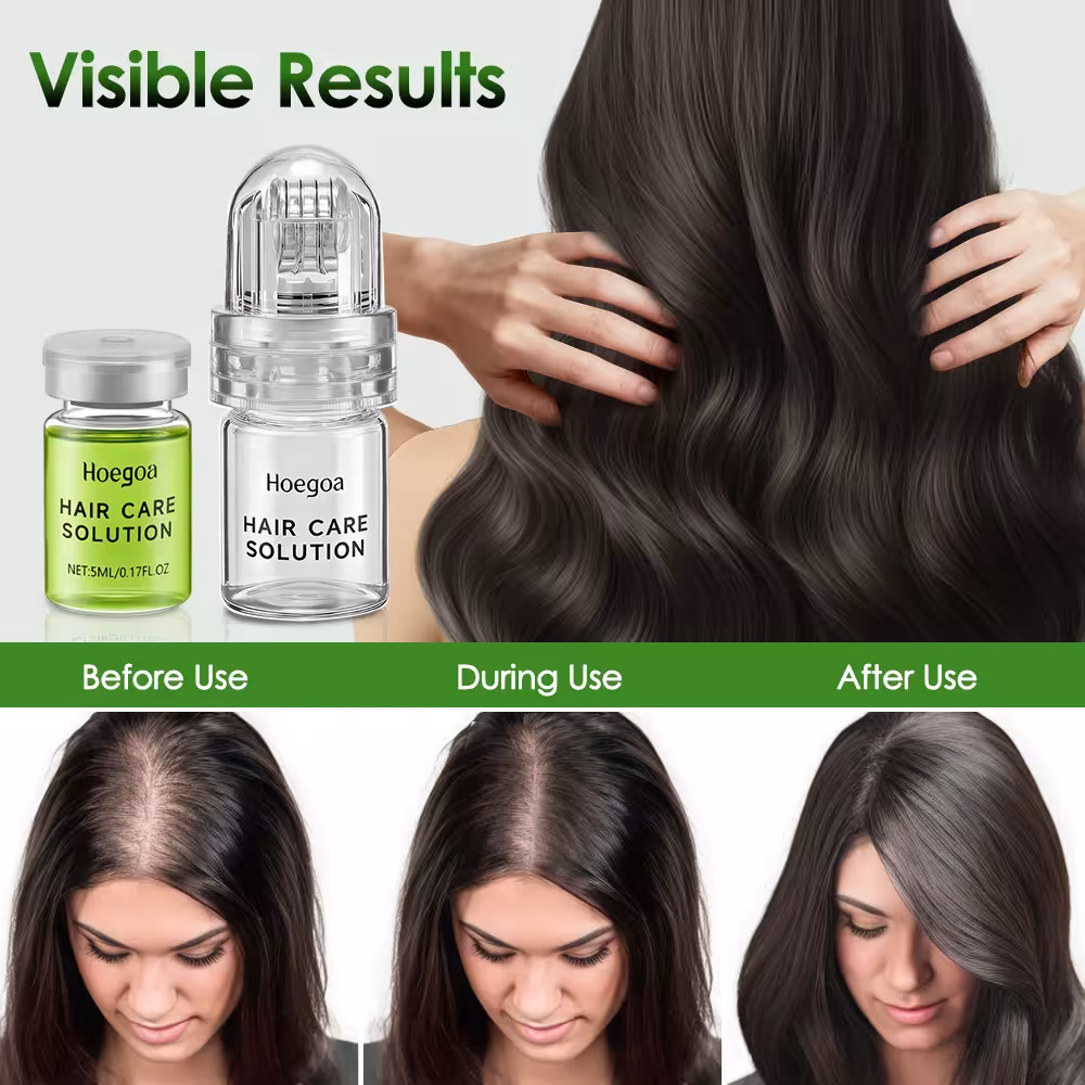 aumento dei capelli siero