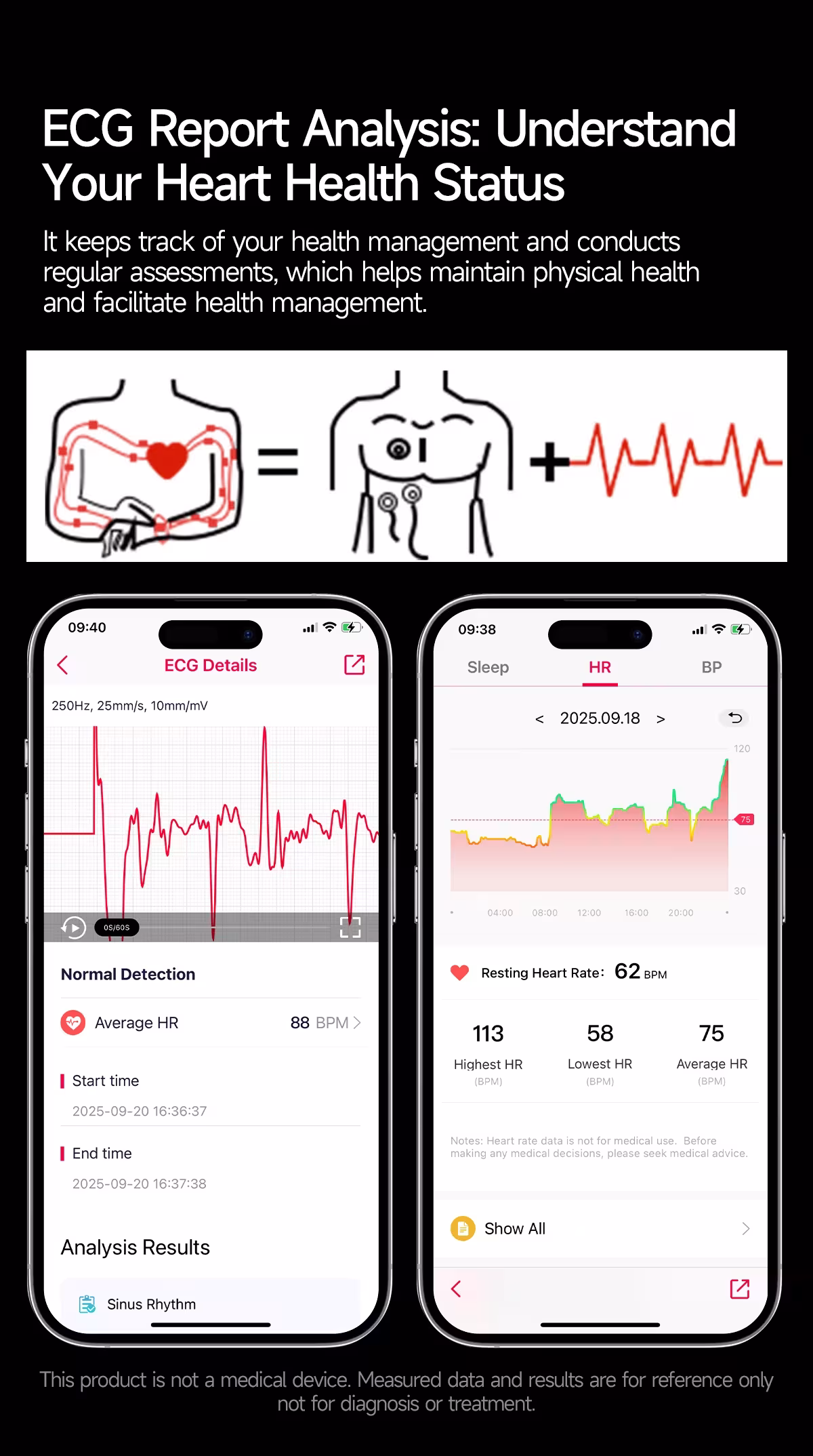 išmanus laikrodis ECG PPG
