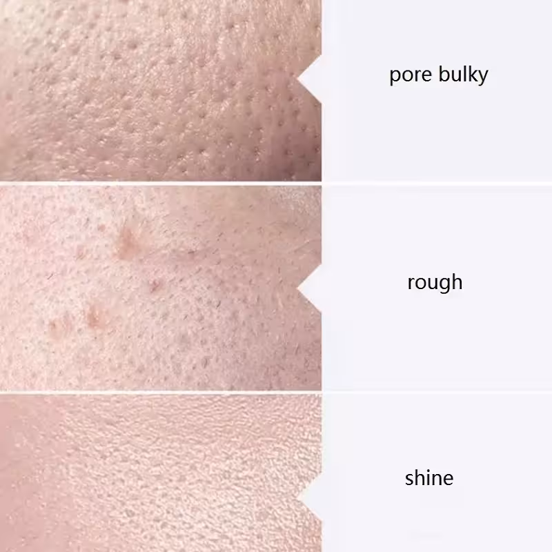 face serum aqua peeling