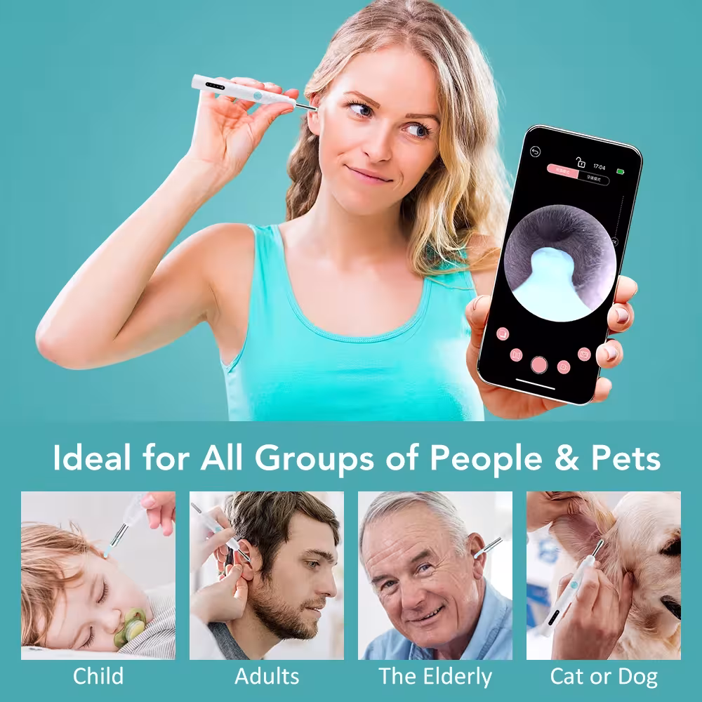 ear cleaning camera