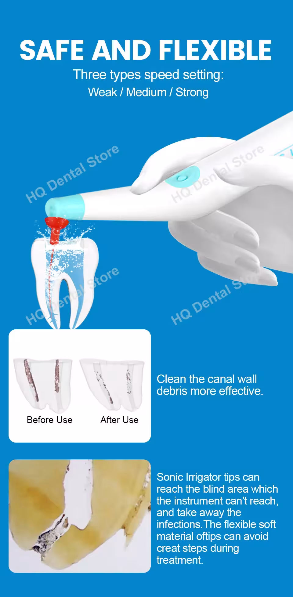 endododonic sonic irrigator para dientes
