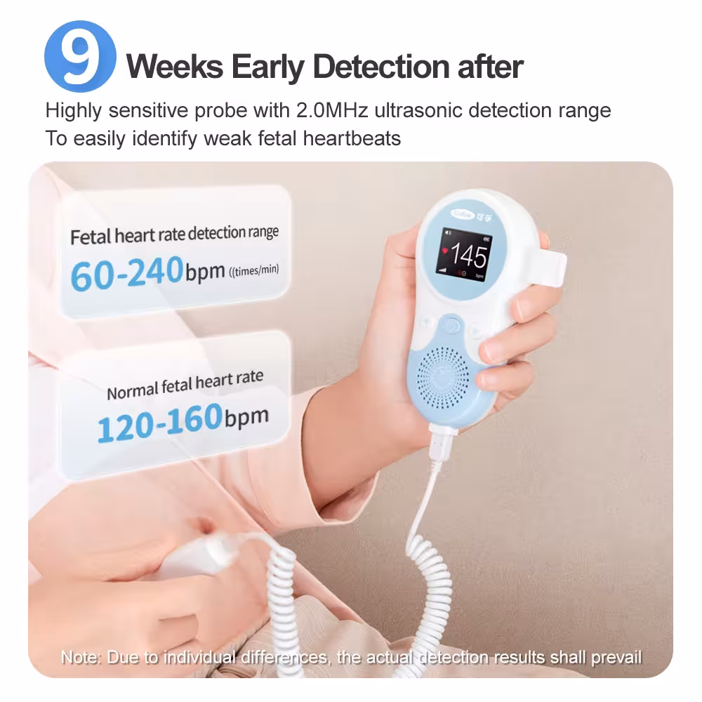 doppler fœtal cardiaque