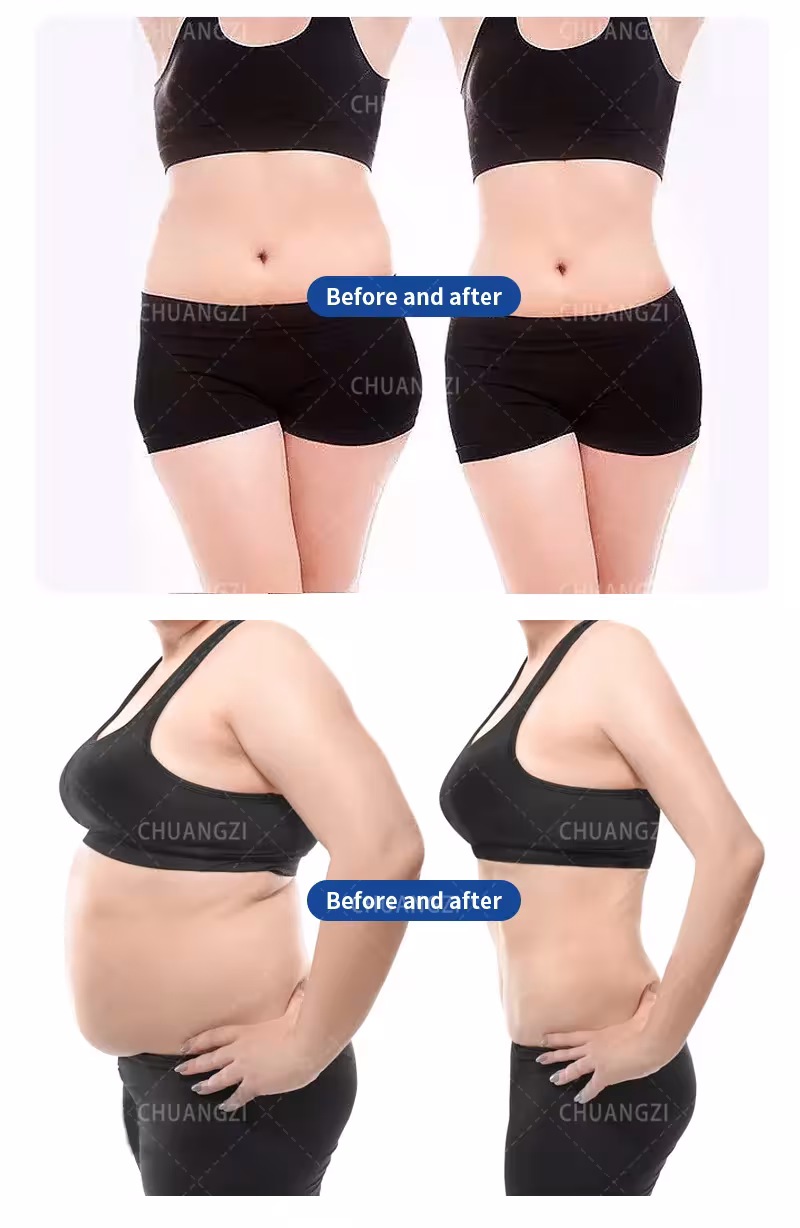 EMS body sculpting device