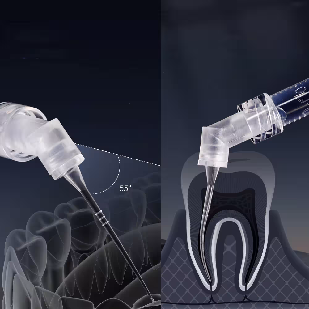 endodontinė irrigacijos adata