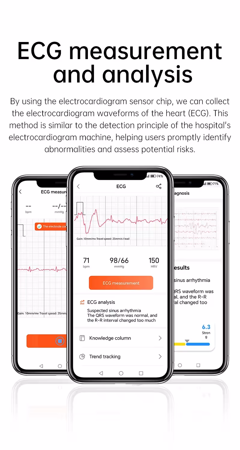 išmanioji sveikatos apyrankė