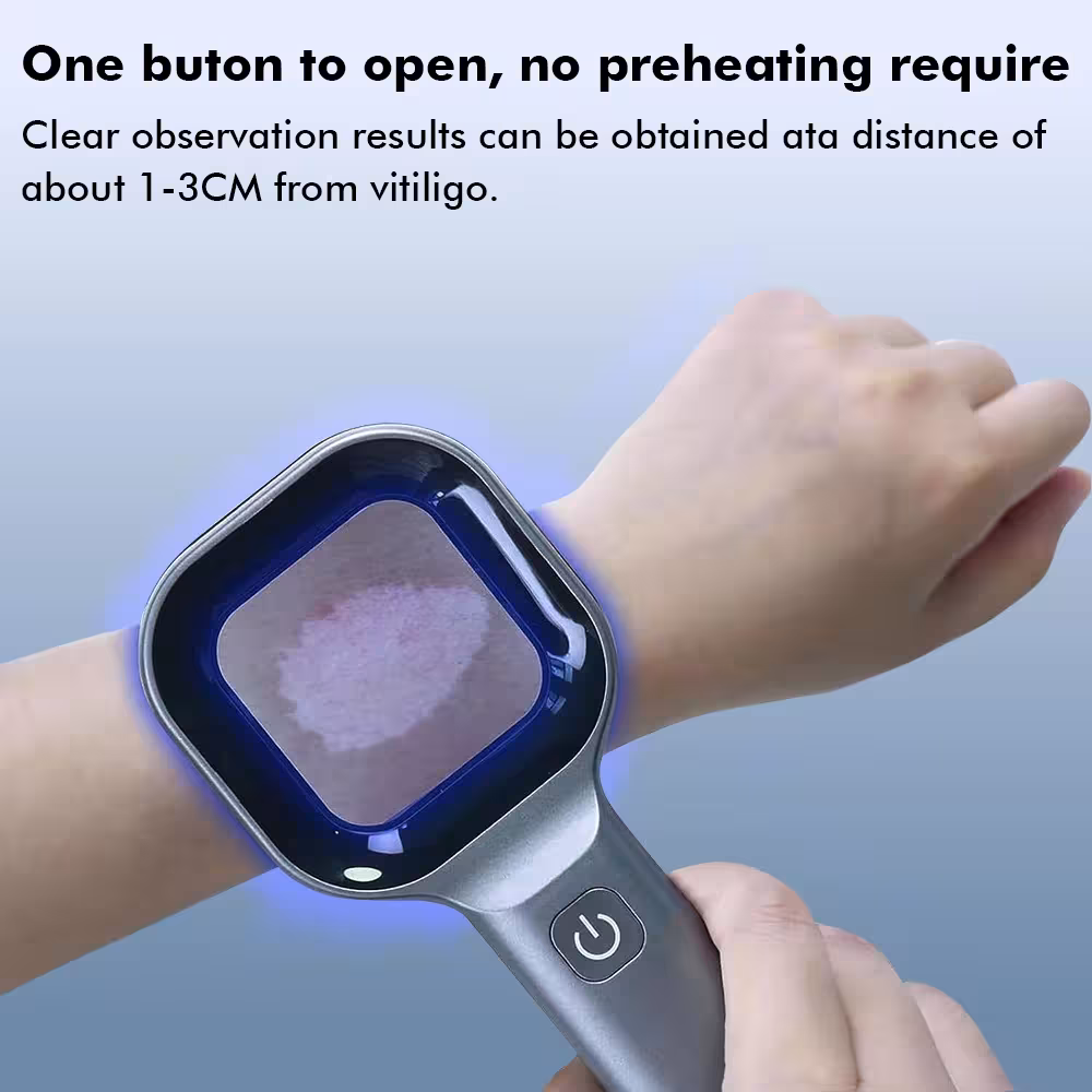 UV-Hautanalysator