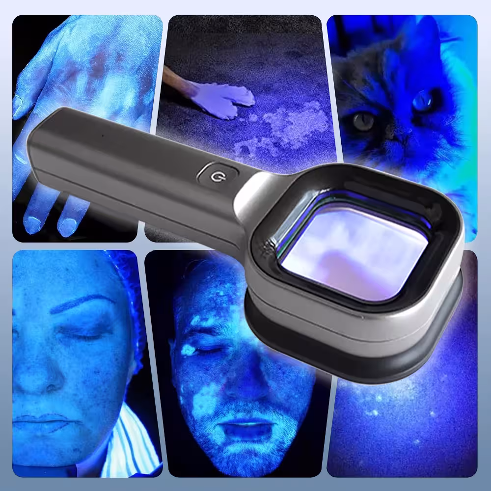 UV-Hautanalysator