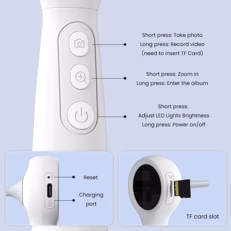 otoscope vidéo