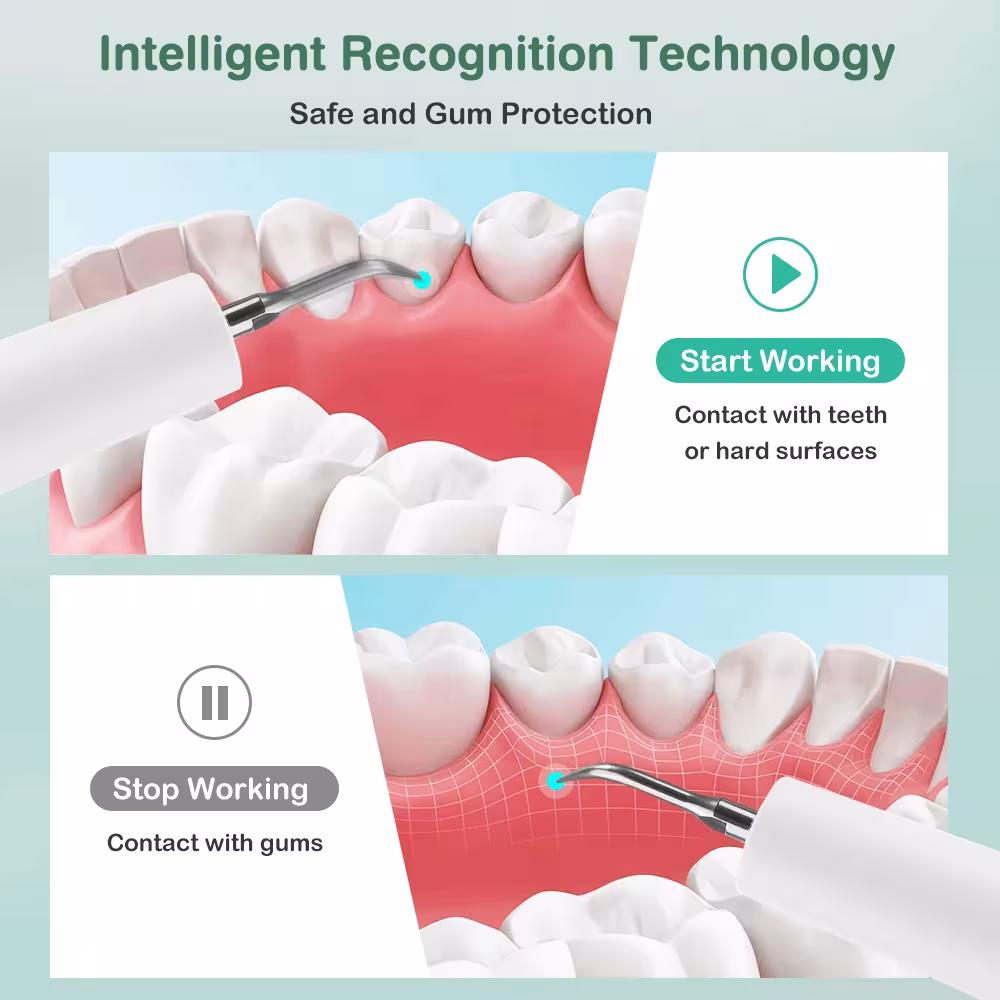 scalatore di denti ultrasuoni