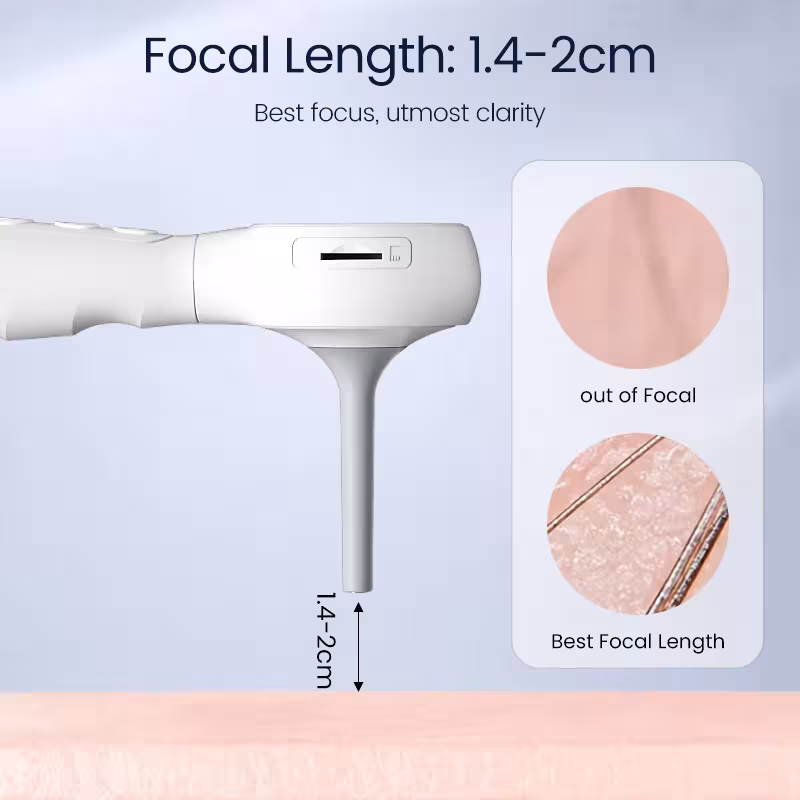 otoscope vidéo